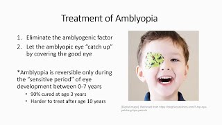 Lazy Eyes and Not So Lazy Eyes Amblyopia Strabismus and Common Pediatric Eye Conditions [upl. by Zelten]