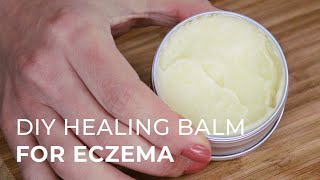 Tutorial for making a Natural Healing Cream for Eczema and Psoriasis [upl. by Ahsita]