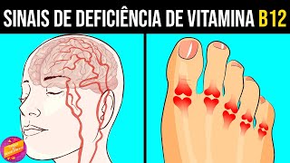 9 Sinais e Sintomas de Deficiência de Vitamina B12 [upl. by Jemine907]