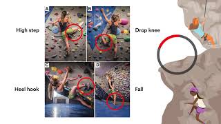 Patterns of knee injury among bouldering and rockclimbing athletes [upl. by Edialeda]