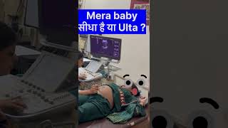 Baby seedha hai [upl. by Azpurua]