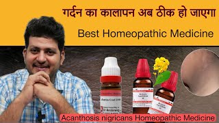 गर्दन का कालापन अब ठीक हो जाएगा  Homeopathic Medicine  Acanthosis nigricans [upl. by Aleemaj]