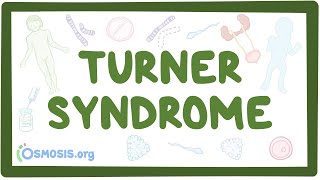 Turner syndrome Year of the Zebra [upl. by Hayes]