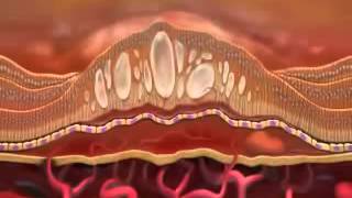 Lucentis ranibizumab [upl. by Turro331]