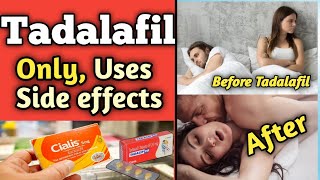 Tadalafil  Tadalafil 20mg Tablet Uses in Hindi [upl. by Zullo537]