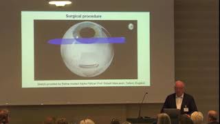 USH2018 Eberhart Zrenner Retina Implantat und Elektrostimulation [upl. by Ennaira347]