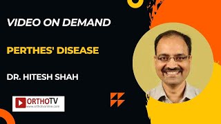 Perthes Disease  Dr Hitesh Shah [upl. by Fee75]