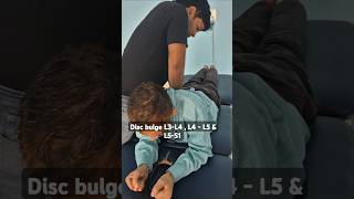 Chiropractic Relief for L3L5 Disc Bulge youngspineclinic [upl. by Edmund]