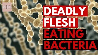 The Disturbing Truth About FleshEating Bacteria MUST WATCH [upl. by Newob51]