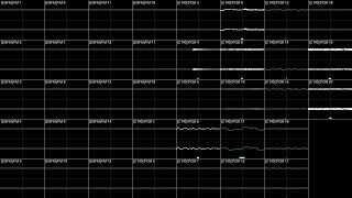 31 Week Krystalclear Ahead ESFM  C140 2MB [upl. by Mis]