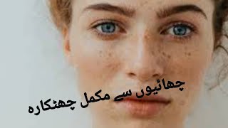 Freckle treatmentpigmentation permanent curechayun is ilaj [upl. by Ecart178]