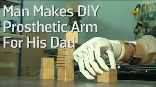 Man Makes DIY Prosthetic Arm For His Dad [upl. by Merdith955]