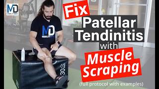 Full Muscle Scraping Protocol for Patellar Tendinitis  Gua Sha Routine [upl. by Dzoba641]