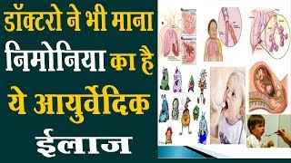 Home Remedies Pneumonia in Hindi  निमोनिया के घरेलू उपचार  treatment of pneumonia in hindi [upl. by Yelsiap354]