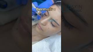 Skin treatment pigmentation treatment  Facial for skin glow  glowing skin facial [upl. by Letram703]