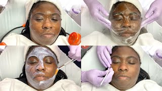 Summer Time Brightening Chemical Peel  GlamByLiaLeigh [upl. by Olrac]