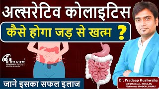 Ulcerative colitis ko kese roke  Ulcerative colitis ka ilaj  Treatment of ulcerative colitis [upl. by Eahs]