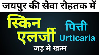 स्किन एलर्जी का स्थाई इलाज   चर्म रोग [upl. by Ylelhsa]