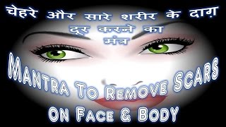 Mantra To Remove Scars on Face amp Body  Shabar Mantra [upl. by Clementi641]