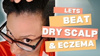 Dealing with Eczema and Scalp Buildup Natural Hair Care Journey [upl. by Kotto]