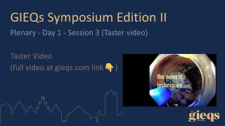 Plenary  Day 1  Session 3 Taster video [upl. by Duston92]