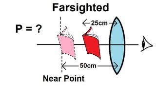 Physics  Optics Vision Correction 4 of 5 Farsighted [upl. by Hime185]