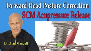 Forward Head Posture Correction SCM Acupressure Release  Dr Mandell [upl. by Hploda731]