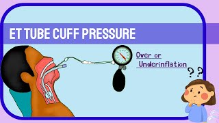 Endotracheal Cuff pressure Underinflation amp Overinflation [upl. by Lanna]