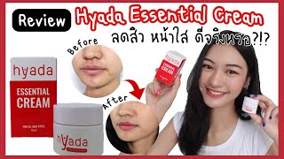 Review Hyada Essential Cream ครีมไฮยาดา ลดสิว หน้าใส ดีจริงหรอ คนขอเข้ามาเยอะมาก [upl. by Iana]