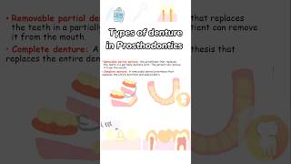 Types of denture introductionprosthodontics denturedr dentistry dentalcrownddsmdsbdsneet [upl. by Enyleve]