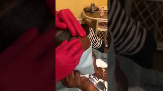 😱BIGGEST BLACKHEAD REMOVAL EVER😱 [upl. by Barbaraanne]