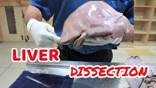 Anatomy Dissection of Liver [upl. by Keele852]