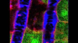 NIDCR Liver Vascular Flow [upl. by Einittirb]