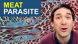 Why I would not eat this meat  Parasite Worms in meat under the microscope [upl. by Sarene]