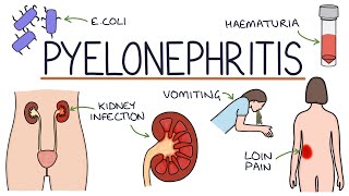 Understanding Pyelonephritis Kidney Infections [upl. by Wilek789]