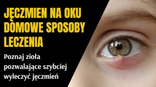 Jęczmień na oku domowe sposoby leczenia [upl. by Eniksre]