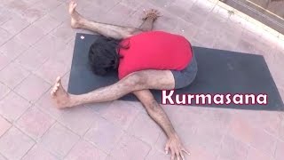 Kurmasana and Supta Kurmasana  Tortoise Pose  Ashtanga Power Yoga  Vyfhealth [upl. by Rose738]