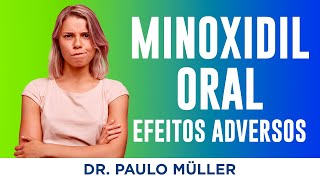 Quais os Efeitos Colaterais Mais comuns do Minoxidil Oral – Dr Paulo Müller Dermatologista [upl. by Livingston]