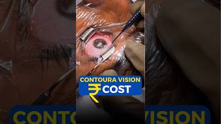 Contoura Vision Cost [upl. by Jordanson]