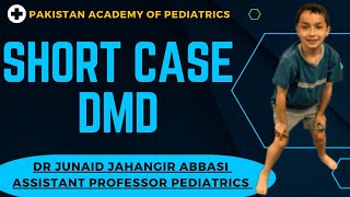 Short Case DMD Duchenne muscular dystrophy ByDrJunaidJahangirAbbasi [upl. by Ahsilrae]