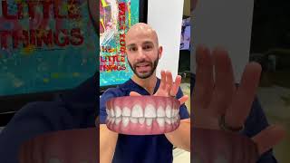 Why I DON’T want to extract this tooth doing Invisalign [upl. by Dionis]