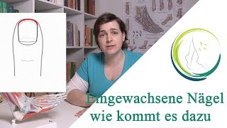 Eingewachsene Nägel wie kommt es dazu podologinandrea [upl. by Anecuza]