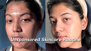 How I got rid of my ACNE SCARS amp TEXTURE  My Unsponsored Skincare Routine 🧴🫧🧖 [upl. by Nottage]