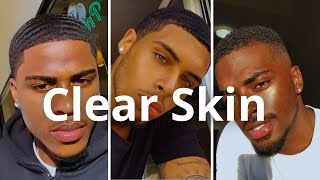 How To Get Clear Skin Naturally [upl. by Pantin205]