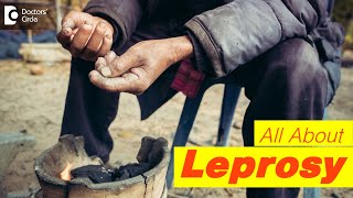 5 Symptoms of Leprosy  Types of Leprosy World Leprosy Day 2021DrRashmi Ravindra Doctors Circle [upl. by Fessuoy92]