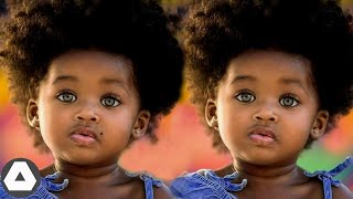 10 Rarest Black Twins Who Are One In a Million [upl. by Cocke]