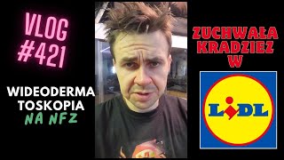 Vlog 421 Kradzież w Lidlu Wideodermatoskopia Warszawa bez kolejki i na NFZ [upl. by Macpherson370]