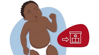 How to Identify Chest Indrawing [upl. by Bender]