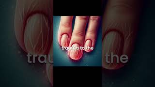 Fingernail Growth Faster Than Toenails Science Explained [upl. by Alodi402]