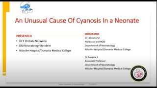 An unusual cause of cyanosis in Neonate [upl. by Eelarual]